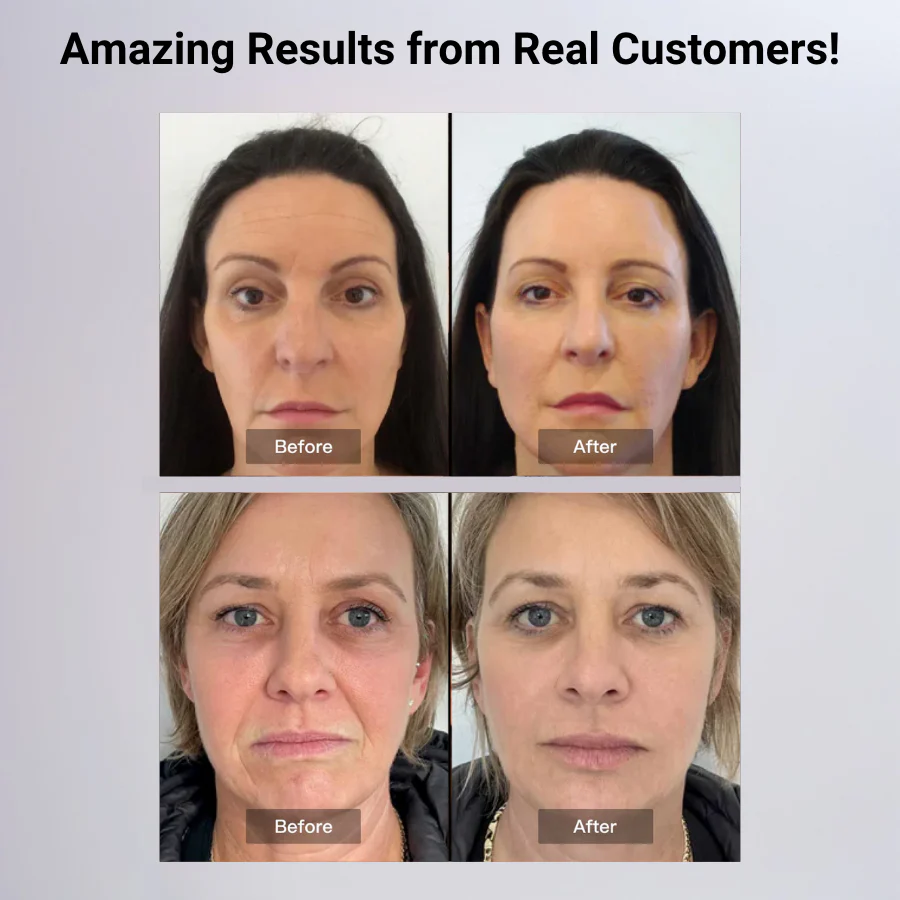 Vantelle LivYoung Face Mask